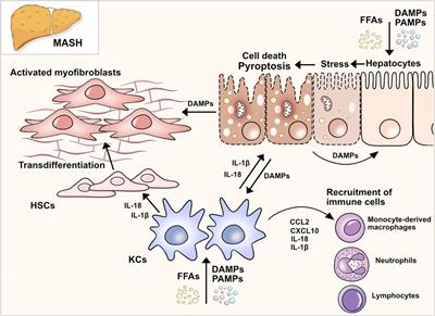 Pyroptosis and gasdermins—Emerging insights and therapeutic opportunities in metabolic dysfunction-associated steatohepatitis